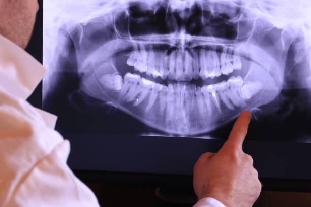 Best Holiday Emergency Dentist in Owosso, MI