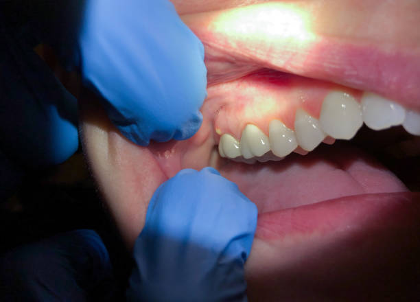 Best Emergency Dentist for Special Needs Patients in Owosso, MI