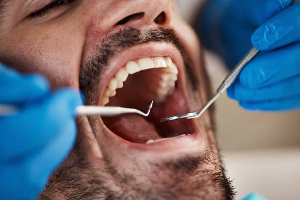 Best Emergency Dentist for Knocked-Out Tooth in Owosso, MI